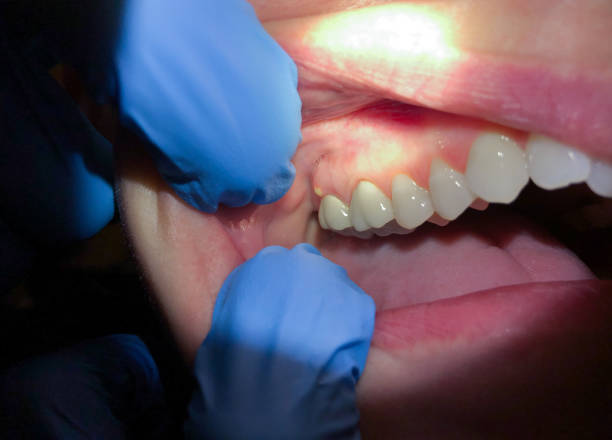 Best Emergency Dentist Near Me  in Glade Spring, VA