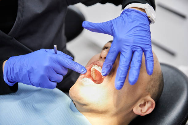 Best Urgent Tooth Repair  in Glade Spring, VA